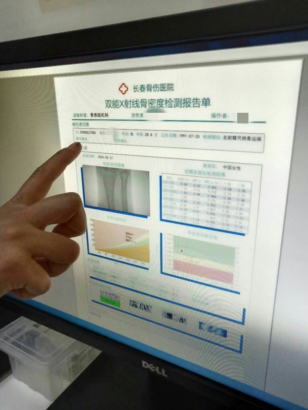 品源雙能X射線骨密度儀落戶吉林省長春骨傷醫(yī)院，助力骨松診療