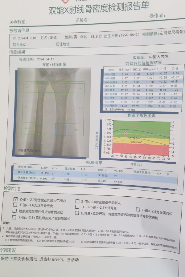 雙能X射線骨密度儀：準(zhǔn)確測量骨密度，助力骨質(zhì)疏松防治，守護(hù)骨骼健康
